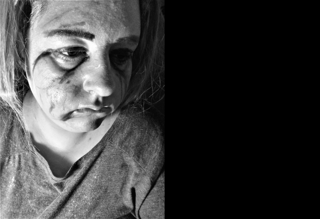 Schwarzes und weißes Foto einer Frau mit Gesichtsverletzungen, ernster Miene, konzentriertem Blick, zurückgebundenem Haar, trägt ein T-Shirt.